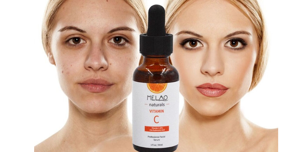 How to Choose the Right Laser Projector for Your Needs